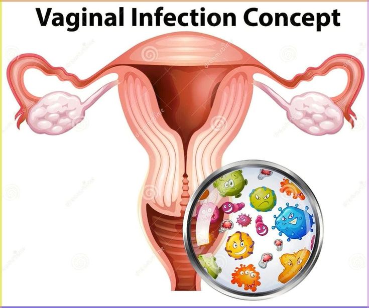 <p><strong>Vaginal imbalance</strong></p>